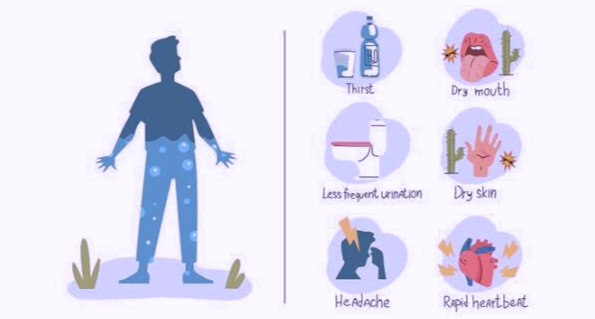 Dehydration Symptoms